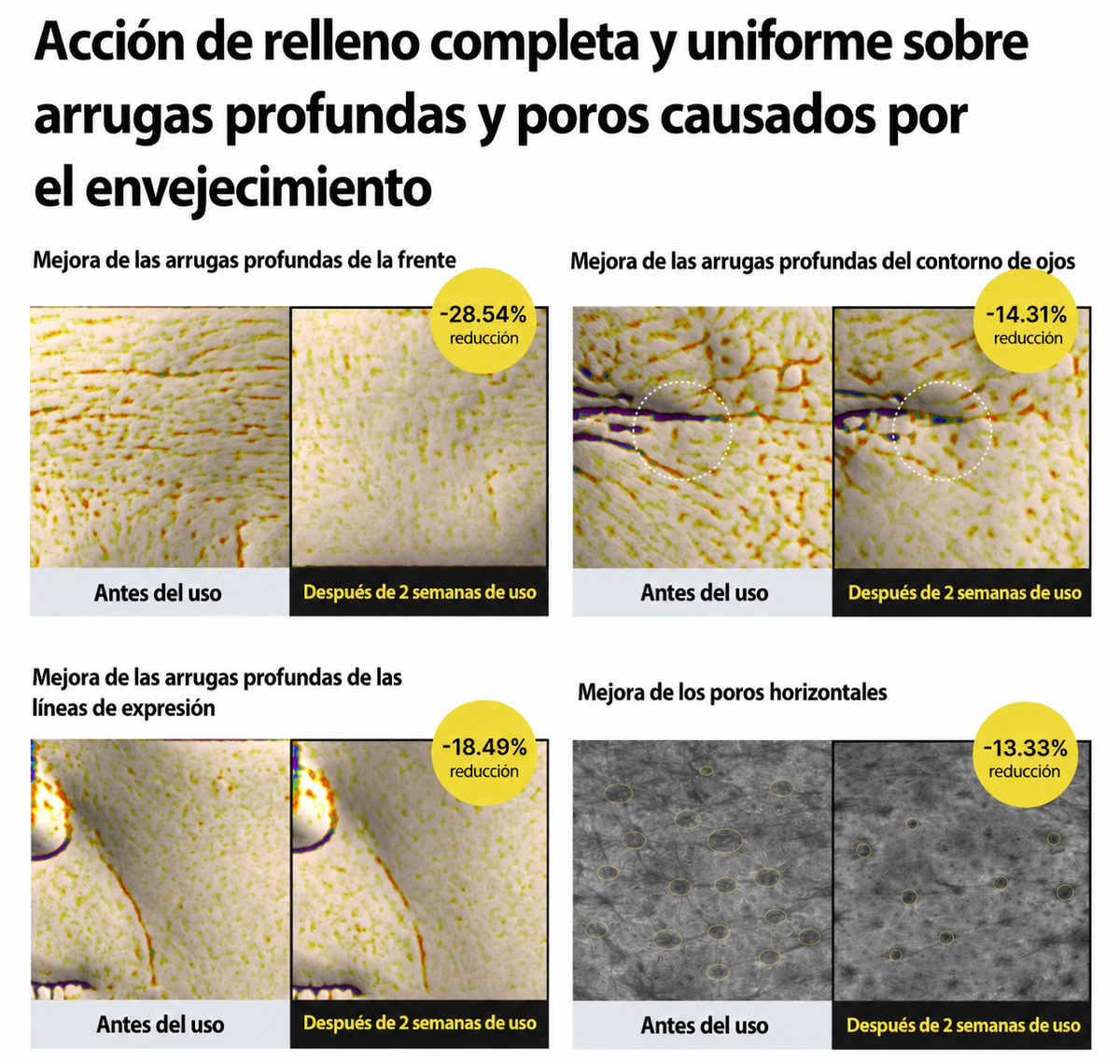 Accion sobre arrugas profundas